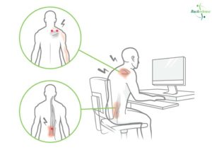 What are Trigger Points