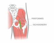 Piriformis Syndrom